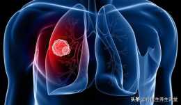 預防肺癌的方法？