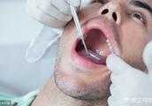 口腔癌早期是什麼症狀？