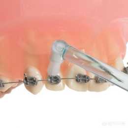 牙齒正畸期間如何護理口腔？