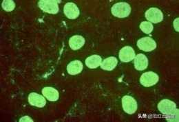 人體生殖道支原體是細菌還是細胞?怎麼從科學角度解釋?