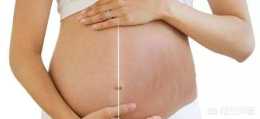 懷孕7個月搽橄欖油還有用沒有？