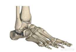 根骨粉碎性骨折的康復訓練應該怎麼做？