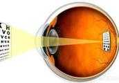 左眼視力0.6，右眼視力0.5是否近視？如果近視是否可以矯正？