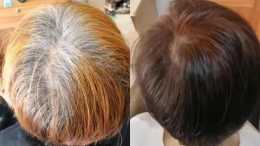 30歲頭髮全白了，每剪一次染一次，頻繁染髮對身體有害嗎？