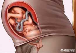 胎兒的頭是向下的，為什麼不會頭暈？